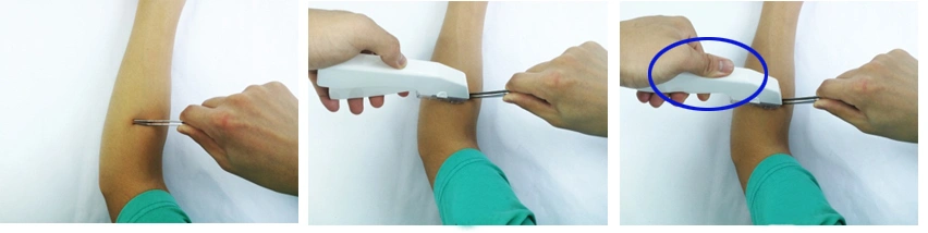 Agrafeuses de peau médicale jetable et solvants chirurgicaux d'agrafeuse avec du CE